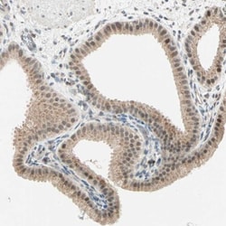 RIZ1 Antibody, Novus Biologicals:Antibodies:Primary Antibodies